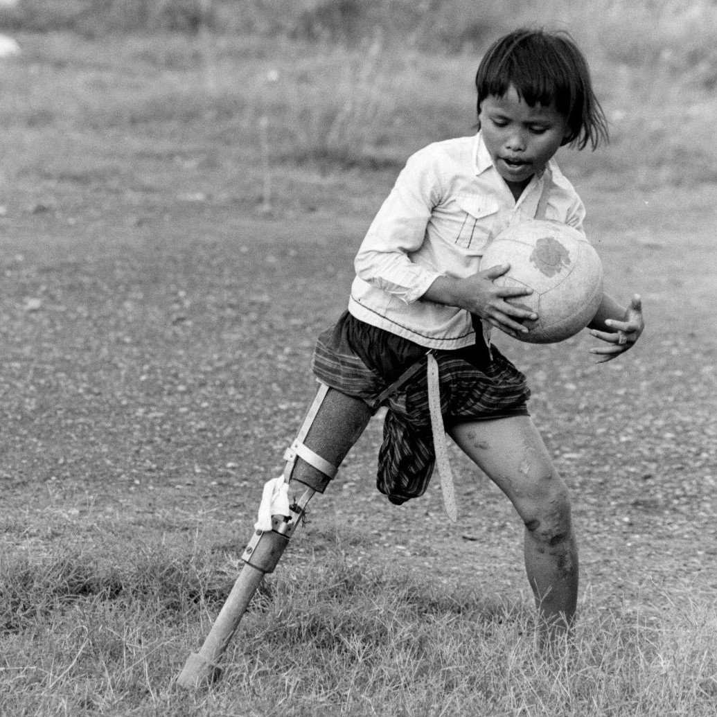 Gniep plays with a soccer ball and runs with her prosthetic leg 