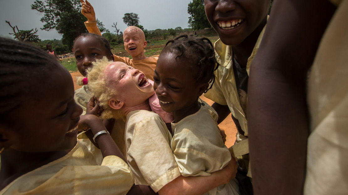 Aicha joue avec ses amis dans la cour de son école. Aicha est albinos, elle a 10 ans et elle vit à Bissau.
