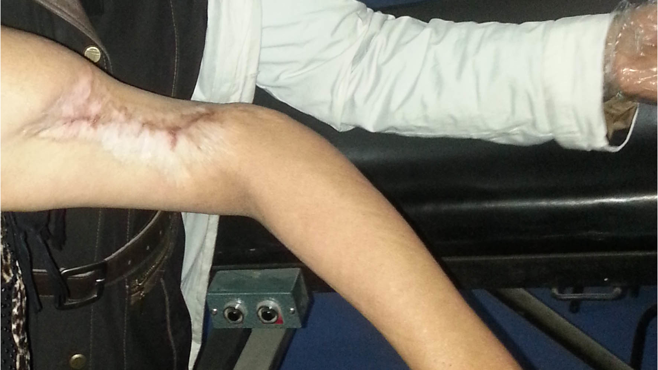 La blessure d’Em Mohamad. 