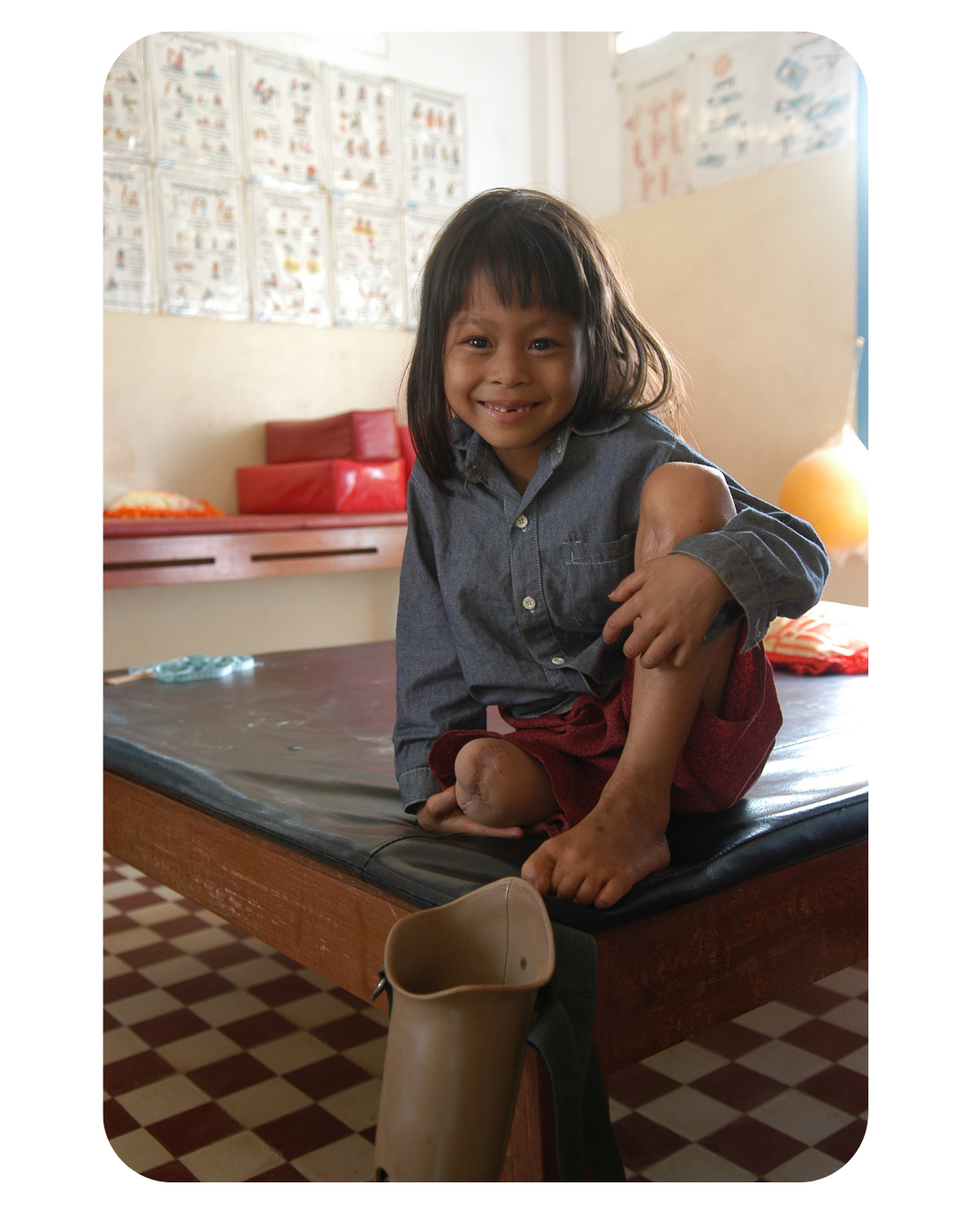 Little girl with a prosthetic sitting and smiling