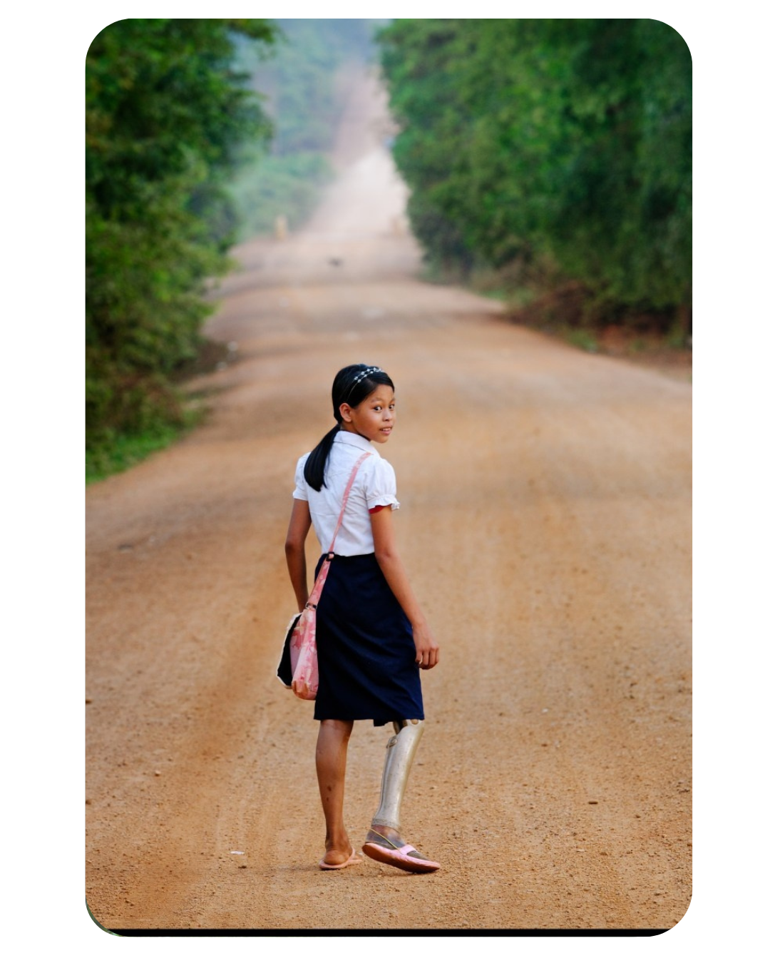 School girl walking with a bag and prosthetic
