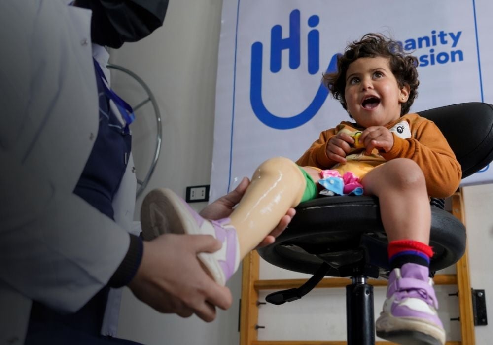 A young girl smiles as a doctor adjusts her prosthetic leg