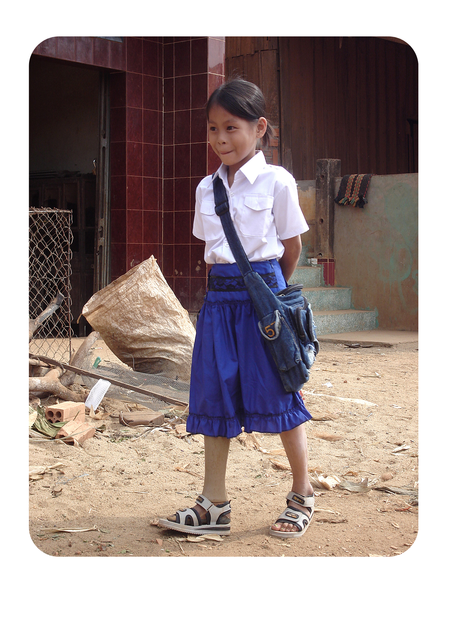 Little girl with a prosthetic standing and smiling