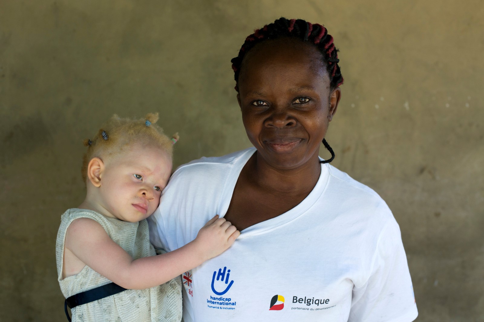 Helene (35 ans) tient dans ses bras sa fille Marie Helen (1 an et demi) atteinte d’albinisme. Kinshasa, RDC. 2019 © Karel Prinsloo/HI