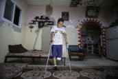 Un enfant de 11 ans blessé lors d’une manifestation à Gaza le 12 mai dernier. 