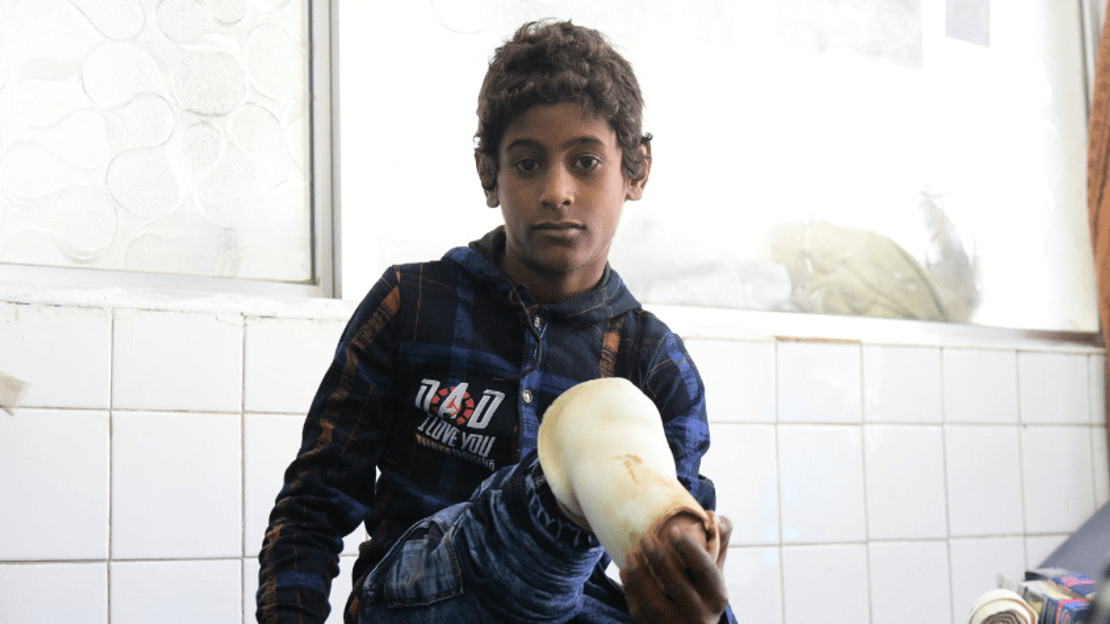 Abdullah a 12 ans. Gravement blessé lors d'un bombardement aérien en décembre 2019 alors qu'il jouait dehors avec des amis, il a dû être amputé.