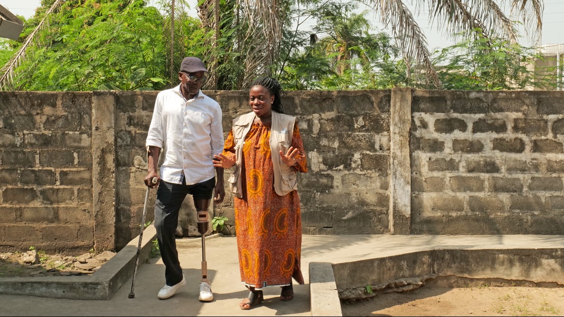 Getting back on his feet after an accident: Souleyman is walking thanks to his prosthesis