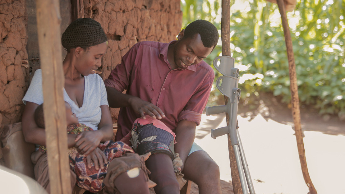 Un homme et une femme sont assis à l'entrée d'une maison en torchis. Ils ont chacun une prothèse de jambe et des béquilles sont appuyées sur un pilier.
